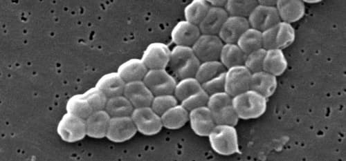 A scanning electron micrograph (SEM) of a highly magnified cluster of Gram-negative, non-motile en:Acinetobacter baumannii bacteria, Janice Carr, Public Domain, Wikipedia Commons アシネトバクター菌の画像