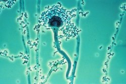 Aspergillus fumigatus, US Department of Health and Human Services (11 February 2006) Public Domain, Wikipedia アスペルギルス・フミガータスの画像