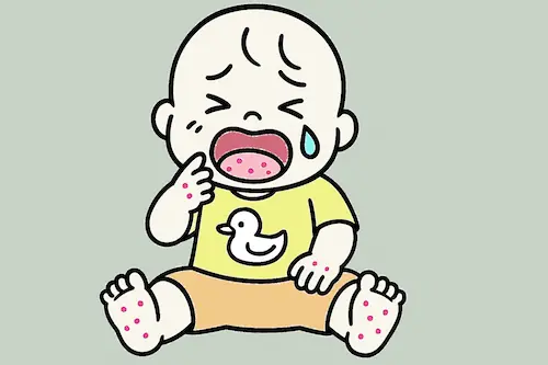 手足口病に感染して泣く子供